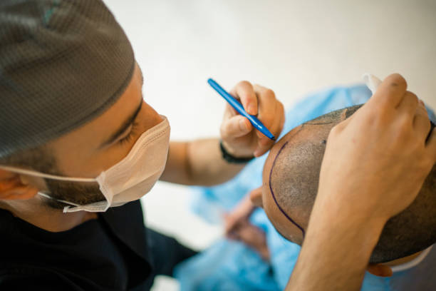 Hair Transplant clinic in delhi